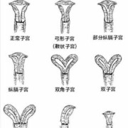 弓形子宫对胎儿的危害（弓形子宫对胎儿的危害）
