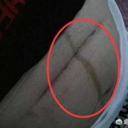 孕期妊娠线（为什么怀孕没有妊娠线啊）