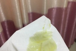孕期白带脓性（孕妇白带发绿怎么办）