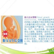 胎儿宫内生长受限指南（胎儿生长受限，我该怎么办）
