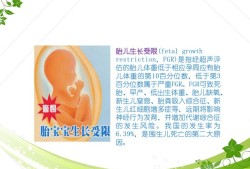 胎儿宫内生长受限指南（胎儿生长受限，我该怎么办）