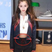 肚子上有一条线，那是不是马甲线,孕期肚皮线看男女