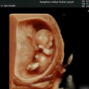 孕13周胎儿稳定了吗,怀孕多久胎儿就稳定了呢