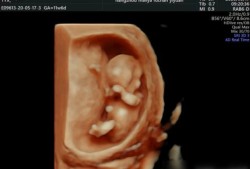 孕13周胎儿稳定了吗,怀孕多久胎儿就稳定了呢