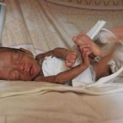 三十五周胎儿能存活吗（早产儿智力会有影响吗）