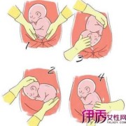 胎儿臀位可以顺产吗（胎儿臀位可以顺产吗?）