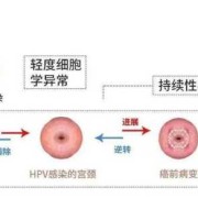 孕11周，水样黄色分泌物，怎么办,孕期水样黄色分泌物