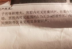 胎儿前后径是什么意思（产后42，天。宫腔分离为前后径约3mm液性暗区是什么意思）