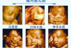 系统胎儿超声检查（系统彩超和四维彩超的区别）