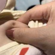 乳头上有结痂怎么办,孕期奶头上有结痂正常吗