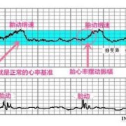 胎儿心率看男孩女孩（胎儿心率看男孩女孩）