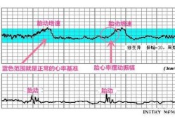 胎儿心率看男孩女孩（胎儿心率看男孩女孩）