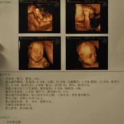 孕8个月做B超每次都看不见宝宝脸怎么办,怀孕8个月胎儿b超图片