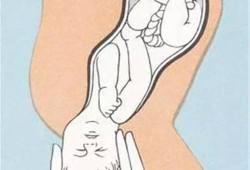 胎儿头大能顺产吗,胎儿大骨盆小能顺产吗视频