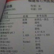 酸碱度7什么意思,孕期酸碱度7.0是男孩女孩?