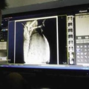 怀孕期间要检查多少次（怀孕期间要检查多少次B超）