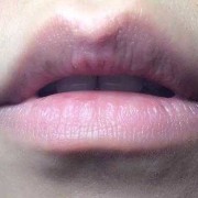 孕期嘴唇变红（孕期嘴唇变红润是男是女）