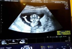 孕13周胎儿稳定了吗,怀孕13周胎儿图片大全
