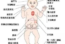 唐氏胎儿在母体的征兆（唐氏胎儿在母体的征兆儿有什么症状）