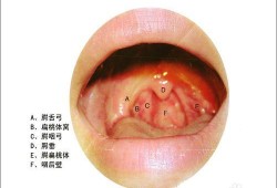 孕期喉咙烧灼（孕期喉咙烧灼感是什么原因引起的）