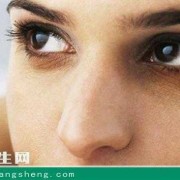 孕期黑眼圈怎么去除（孕期黑眼圈怎么去除小妙招）