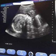 怀孕6个月胎儿有多重（6个月宝宝几天一次大便正常）
