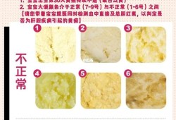 胎儿在肚子大便（胎儿在肚子大便吗）