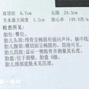 产检b超看什么,孕期b族链球菌是查什么的