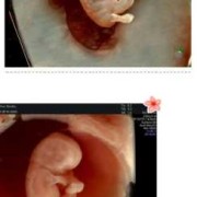 九周胎儿成型了吗（胎儿多少周稳定）