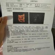 胎儿肾盂分离怎么办（胎儿肾盂分离怎么办好）