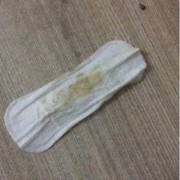 怀孕期间白带多是什么原因（怀孕了白带多怎么办）