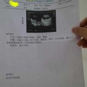 胎儿期停胎（怀孕有胎心胎芽还会引起停胎吗）