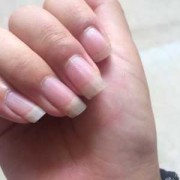 孕期指甲（孕期指甲长得快是什么原因）