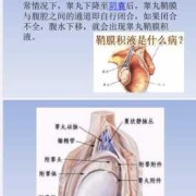 婴儿为什么有睾丸积液怎么治疗需要注意啥,胎儿睾丸积液问题大吗