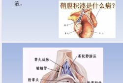 婴儿为什么有睾丸积液怎么治疗需要注意啥,胎儿睾丸积液问题大吗