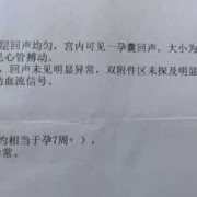 胎儿彩超价格（二维彩超多少钱一次的啊？准备过两天去医院产检的）