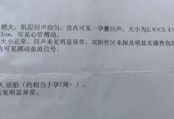 胎儿彩超价格（二维彩超多少钱一次的啊？准备过两天去医院产检的）