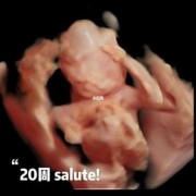 二十周胎儿有多大,怀孕20周胎儿真实图片欣赏