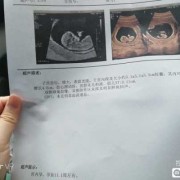 胎儿个子大（别人夸你孩子长得好高怎么回答）