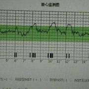 胎儿心跳（胎儿心率快怎么回事）