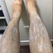 为什么女生腿毛会突然变长,孕期腿毛变长怎么办