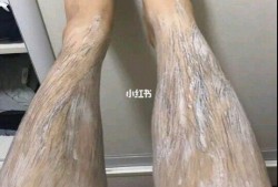 为什么女生腿毛会突然变长,孕期腿毛变长怎么办