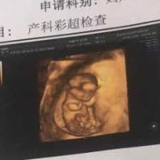 12周胎儿成型了吗（12周胎儿成型了吗）