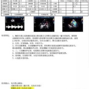 胎儿卵圆孔正常值（怀孕6个月卵圆孔0.55cm能自愈吗）