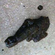 孕期便秘头晕（头晕恶心，大便黑色，中暑）