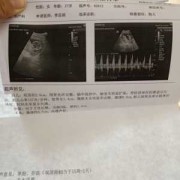 胎儿心率159（胎儿心率159是男孩女孩）