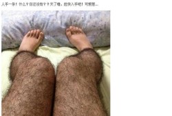 怀孕两个多月肚子上好多毛,孕期腿毛多怎么去除