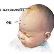 胎儿脑积水还能要吗（宝宝有脑积液怎么办）