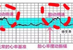胎儿心率低的原因（胎儿心率低的原因有哪些）