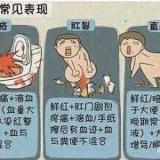 孕期屁眼出血（孕期便秘肛门出血是怎么回事的呢）